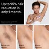 Braun Smart IPL, Skin i·Expert Pro 7: at Home Laser Hair Removal, Permanent Visible Hair Reduction, Vanity Case, Venus Razor, 3 Smart Heads, IPL7243